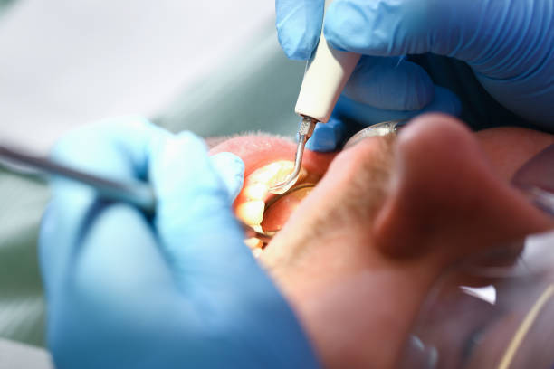 Best Emergency Treatment for Toothache in Winchester, MO