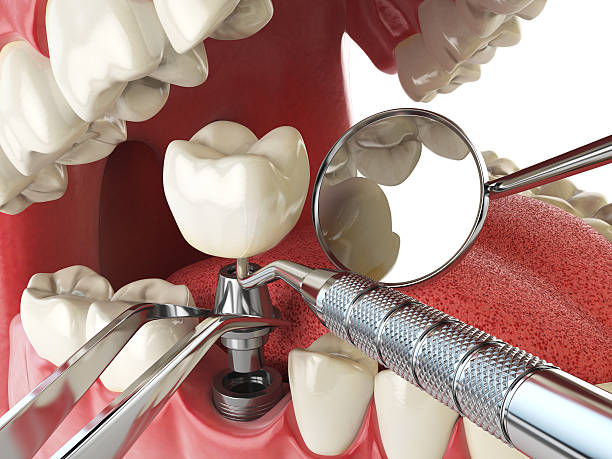 Best Emergency Dental Surgery in Winchester, MO