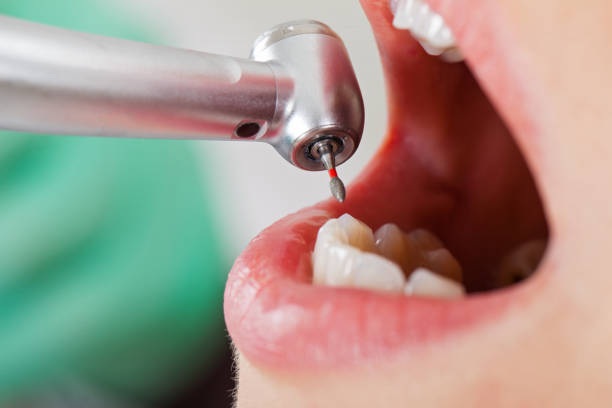 Best Emergency Treatment for Toothache in Winchester, MO